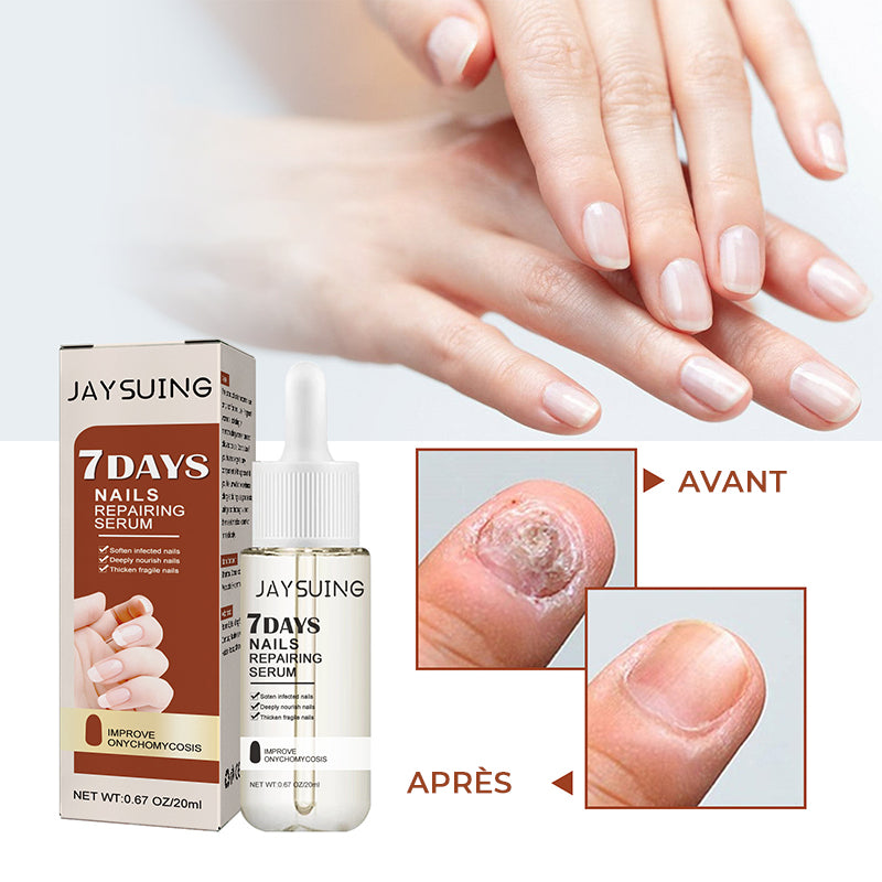 Sérum de Croissance et de Renforcement des Ongles en 7 Jours