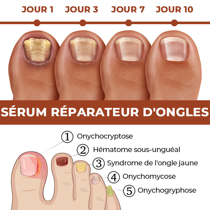Sérum de Croissance et de Renforcement des Ongles en 7 Jours