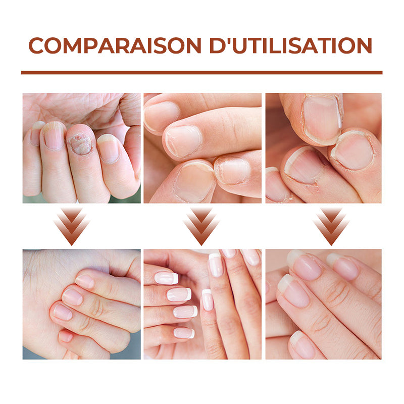Sérum de Croissance et de Renforcement des Ongles en 7 Jours